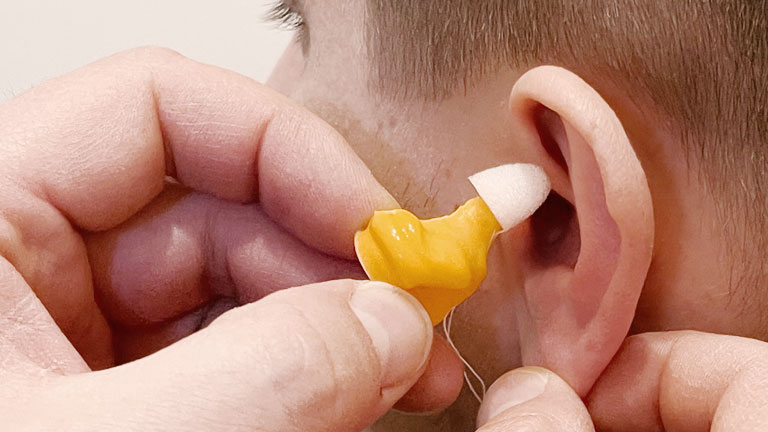 Ihre angepasste Otoplastik WEIXLER